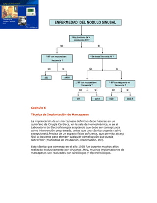 Capitulo 6
Técnica de Implantación de Marcapasos
La implantación de un marcapasos definitivo debe hacerse en un
quirófano de Cirugía Cardiaca, en la sala de Hemodinámica, o en el
Laboratorio de Electrofisiología aceptando que debe ser conceptuada
como intervención programada, antes que una técnica urgente (salvo
excepciones).Precisa de un espacio físico suficiente, que permita acceso
fácil al paciente para atender cualquier complicación que pueda
sobrevenir (maniobras de intubación, reanimación, etc).
Esta técnica que comenzó en el año 1958 fue durante muchos años
realizado exclusivamente por cirujanos .Hoy, muchas implantaciones de
marcapasos son realizadas por cardiólogos y electrofisiólogos.
 