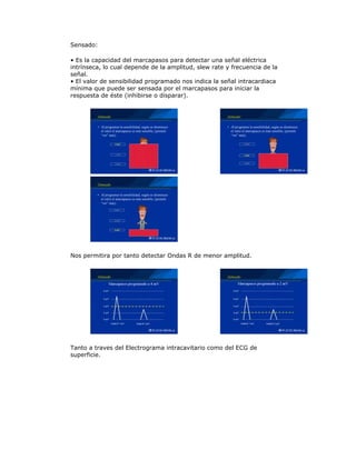 Sensado:
• Es la capacidad del marcapasos para detectar una señal eléctrica
intrínseca, lo cual depende de la amplitud, slew rate y frecuencia de la
señal.
• El valor de sensibilidad programado nos indica la señal intracardiaca
mínima que puede ser sensada por el marcapasos para iniciar la
respuesta de éste (inhibirse o disparar).
Nos permitira por tanto detectar Ondas R de menor amplitud.
Tanto a traves del Electrograma intracavitario como del ECG de
superficie.
 