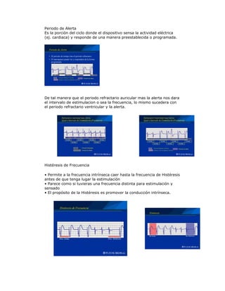 Periodo de Alerta
Es la porción del ciclo donde el dispositivo sensa la actividad eléctrica
(ej. cardiaca) y responde de una manera preestablecida o programada.
De tal manera que el periodo refractario auricular mas la alerta nos dara
el intervalo de estimulacion o sea la frecuencia, lo mismo sucedera con
el periodo refractario ventricular y la alerta.
Histéresis de Frecuencia
• Permite a la frecuencia intrínseca caer hasta la frecuencia de Histéresis
antes de que tenga lugar la estimulación
• Parece como si tuvieras una frecuencia distinta para estimulación y
sensado
• El propósito de la Histéresis es promover la conducción intrínseca.
 