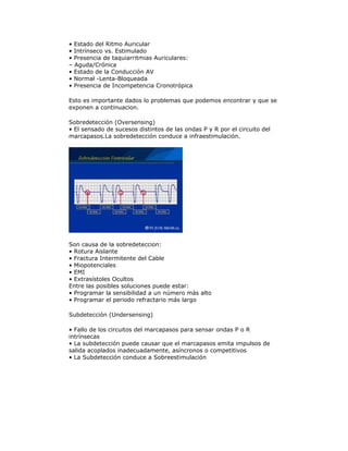 • Estado del Ritmo Auricular
• Intrínseco vs. Estimulado
• Presencia de taquiarritmias Auriculares:
– Aguda/Crónica
• Estado de la Conducción AV
• Normal -Lenta-Bloqueada
• Presencia de Incompetencia Cronotrópica
Esto es importante dados lo problemas que podemos encontrar y que se
exponen a continuacion.
Sobredetección (Oversensing)
• El sensado de sucesos distintos de las ondas P y R por el circuito del
marcapasos.La sobredetección conduce a infraestimulación.
Son causa de la sobredeteccion:
• Rotura Aislante
• Fractura Intermitente del Cable
• Miopotenciales
• EMI
• Extrasístoles Ocultos
Entre las posibles soluciones puede estar:
• Programar la sensibilidad a un número más alto
• Programar el periodo refractario más largo
Subdetección (Undersensing)
• Fallo de los circuitos del marcapasos para sensar ondas P o R
intrínsecas
• La subdetección puede causar que el marcapasos emita impulsos de
salida acoplados inadecuadamente, asíncronos o competitivos
• La Subdetección conduce a Sobreestimulación
 