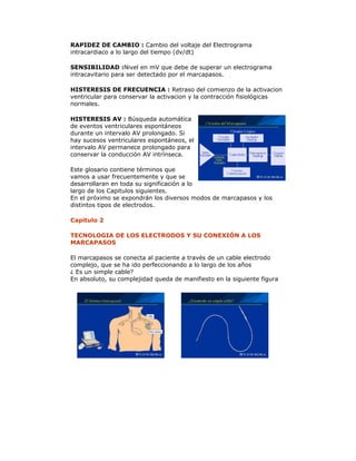 RAPIDEZ DE CAMBIO : Cambio del voltaje del Electrograma
intracardiaco a lo largo del tiempo (dv/dt)
SENSIBILIDAD :Nivel en mV que debe de superar un electrograma
intracavitario para ser detectado por el marcapasos.
HISTERESIS DE FRECUENCIA : Retraso del comienzo de la activacion
ventricular para conservar la activacion y la contracción fisiológicas
normales.
HISTERESIS AV : Búsqueda automática
de eventos ventriculares espontáneos
durante un intervalo AV prolongado. Si
hay sucesos ventriculares espontáneos, el
intervalo AV permanece prolongado para
conservar la conducción AV intrínseca.
Este glosario contiene términos que
vamos a usar frecuentemente y que se
desarrollaran en toda su significación a lo
largo de los Capitulos siguientes.
En el próximo se expondrán los diversos modos de marcapasos y los
distintos tipos de electrodos.
Capitulo 2
TECNOLOGIA DE LOS ELECTRODOS Y SU CONEXIÓN A LOS
MARCAPASOS
El marcapasos se conecta al paciente a través de un cable electrodo
complejo, que se ha ido perfeccionando a lo largo de los años
¿ Es un simple cable?
En absoluto, su complejidad queda de manifiesto en la siguiente figura
 