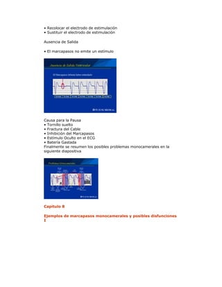 • Recolocar el electrodo de estimulación
• Sustituir el electrodo de estimulación
Ausencia de Salida
• El marcapasos no emite un estímulo
Causa para la Pausa
• Tornillo suelto
• Fractura del Cable
• Inhibición del Marcapasos
• Estímulo Oculto en el ECG
• Batería Gastada
Finalmente se resumen los posibles problemas monocamerales en la
siguiente diapositiva
Capitulo 8
Ejemplos de marcapasos monocamerales y posibles disfunciones
I
 