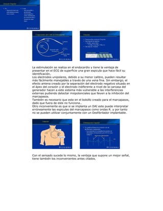 La estimulación se realiza en el endocardio y tiene la ventaja de
presentar en el ECG de superficie una gran espicula que hace fácil su
identificación,
Los electrodos unipolares, debido a su menor calibre, pueden resultar
más fácilmente manejables a través de una vena fina. Sin embargo, el
efecto antena creado por la separación del electrodo negativo situado en
el ápex del corazón y el electrodo indiferente a nivel de la carcasa del
generador hacen a este sistema más vulnerable a las interferencias
externas pudiendo detectar miopotenciales que lleven a la inhibición del
marcapasos.
También es necesario que este en el bolsillo creado para el marcapasos,
dado que fuera de este no funciona..
Otro inconveniente es que si se implanta un DAI este puede interpretar
erróneamente las espiculas del marcapasos como ondas R. y por tanto
no se pueden utilizar conjuntamente con un Desfibrilador implantable.
Con el sensado sucede lo mismo, la ventaja que supone un mejor señal,
tiene también los inconvenientes antes citados.
 