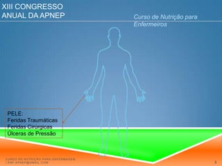 XIII Congresso Anual da APNEPCurso de Nutrição para EnfermeirosPELE: Feridas TraumáticasFeridas CirúrgicasÚlceras de PressãoCurso de Nutrição para Enfermagem | enf.apnep@gmail.com3