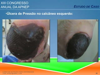 Guidelinese RecomendaçõesNPUAP e EPAUP 2009Curso de Nutrição para Enfermagem | enf.apnep@gmail.com40