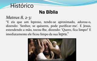 Histórico
Na Bíblia
Mateus 8, 2-3:
“E eis que um leproso, tendo-se aproximado, adorou-o,
dizendo: 'Senhor, se quiseres, pode purificar-me'. E Jesus,
estendendo a mão, tocou-lhe, dizendo: 'Quero, fica limpo!' E
imediatamente ele ficou limpo da sua lepra.”
 