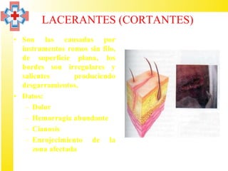 LACERANTES (CORTANTES)
• Son las causadas por
  instrumentos romos sin filo,
  de superficie plana, los
  bordes son irregulares y
  salientes       produciendo
  desgarramientos.
• Datos:
   – Dolor
   – Hemorragia abundante
   – Cianosis
   – Enrojecimiento de la
      zona afectada
 