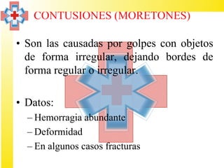 CONTUSIONES (MORETONES)

• Son las causadas por golpes con objetos
  de forma irregular, dejando bordes de
  forma regular o irregular.

• Datos:
  – Hemorragia abundante
  – Deformidad
  – En algunos casos fracturas
 
