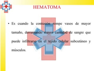 HEMATOMA


• Es cuando la contusión rompe vasos de mayor

 tamaño, derramando mayor cantidad de sangre que

 puede infiltrarse en el tejido celular subcutáneo y

 músculos.
 