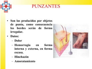 PUNZANTES

• Son las producidas por objetos
  de punta, como consecuencia
  los bordes serán de forma
  irregular.
• Datos:
   – Dolor
   – Hemorragia      en    forma
     interna y externa, en forma
     escasa.
   – Hinchazón
   – Amoratamiento
 