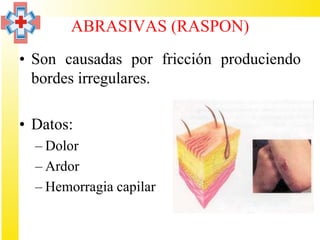 ABRASIVAS (RASPON)
• Son causadas por fricción produciendo
  bordes irregulares.

• Datos:
  – Dolor
  – Ardor
  – Hemorragia capilar
 