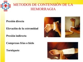 METODOS DE CONTENSIÓN DE LA
               HEMORRAGIA


• Presión directa

• Elevación de la extremidad

• Presión indirecta

• Compresas frías o hielo

• Torniquete
 