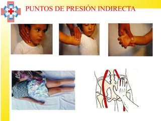 PUNTOS DE PRESIÓN INDIRECTA
 