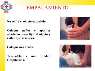 EMPALAMIENTO

• No retire el objeto empalado.

• Coloque paños o apositos
  alrededor para fijar el objeto y
  evitar que se mueva.

• Coloque una venda.

• Trasládelo a      una   Unidad
  Hospitalaria.
 