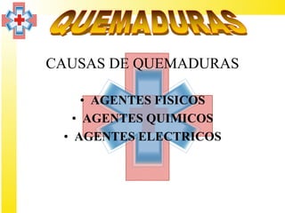 CAUSAS DE QUEMADURAS

     • AGENTES FISICOS
   • AGENTES QUIMICOS
 • AGENTES ELECTRICOS
 