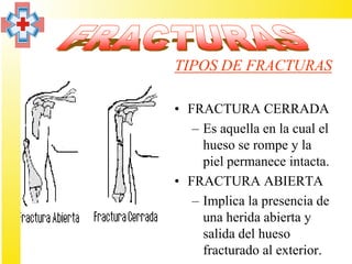 TIPOS DE FRACTURAS

• FRACTURA CERRADA
   – Es aquella en la cual el
     hueso se rompe y la
     piel permanece intacta.
• FRACTURA ABIERTA
   – Implica la presencia de
     una herida abierta y
     salida del hueso
     fracturado al exterior.
 