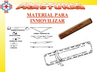 MATERIAL PARA
 INMOVILIZAR
 