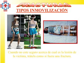 TIPOS INMOVILIZACIÓN




Cuando no este seguro acerca de cual es la lesión de
   la victima, trátela como si fuera una fractura.
 