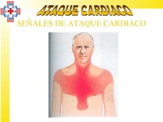 SEÑALES DE ATAQUE CARDIACO
 