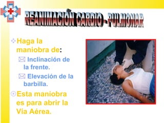 Haga la
 maniobra de:
   Inclinación de
   la frente.
   Elevación de la
   barbilla.
Esta maniobra
 es para abrir la
 Vía Aérea.
 