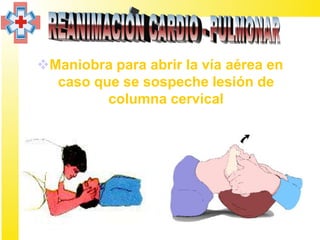 Maniobra para abrir la vía aérea en
  caso que se sospeche lesión de
         columna cervical
 