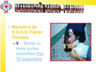 ¤ Maniobra de
  V.O.S.S (Tercer
  Tiempo)
  – V = Sentir si
    tiene pulso
    carotídeo.Por
    10 segundos
 