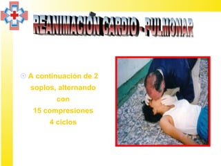  A continuación de 2
  soplos, alternando
         con
   15 compresiones
       4 ciclos
 