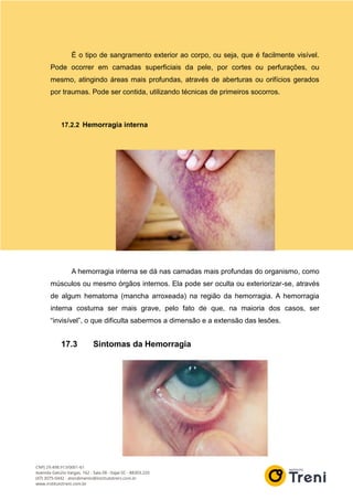 É o tipo de sangramento exterior ao corpo, ou seja, que é facilmente visível.
Pode ocorrer em camadas superficiais da pele, por cortes ou perfurações, ou
mesmo, atingindo áreas mais profundas, através de aberturas ou orifícios gerados
por traumas. Pode ser contida, utilizando técnicas de primeiros socorros.
17.2.2 Hemorragia interna
A hemorragia interna se dá nas camadas mais profundas do organismo, como
músculos ou mesmo órgãos internos. Ela pode ser oculta ou exteriorizar-se, através
de algum hematoma (mancha arroxeada) na região da hemorragia. A hemorragia
interna costuma ser mais grave, pelo fato de que, na maioria dos casos, ser
“invisível”, o que dificulta sabermos a dimensão e a extensão das lesões.
17.3 Sintomas da Hemorragia
 