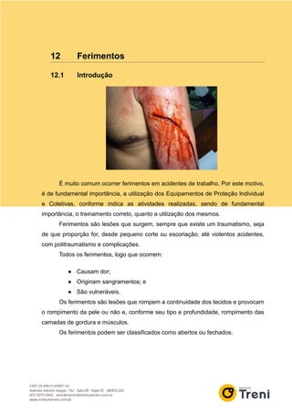 12 Ferimentos
12.1 Introdução
É muito comum ocorrer ferimentos em acidentes de trabalho. Por este motivo,
é de fundamental importância, a utilização dos Equipamentos de Proteção Individual
e Coletivas, conforme indica as atividades realizadas, sendo de fundamental
importância, o treinamento correto, quanto a utilização dos mesmos.
Ferimentos são lesões que surgem, sempre que existe um traumatismo, seja
de que proporção for, desde pequeno corte ou escoriação, até violentos acidentes,
com politraumatismo e complicações.
Todos os ferimentos, logo que ocorrem:
● Causam dor;
● Originam sangramentos; e
● São vulneráveis.
Os ferimentos são lesões que rompem a continuidade dos tecidos e provocam
o rompimento da pele ou não e, conforme seu tipo e profundidade, rompimento das
camadas de gordura e músculos.
Os ferimentos podem ser classificados como abertos ou fechados.
 