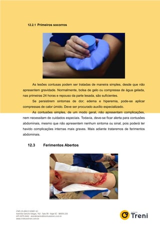 12.2.1 Primeiros socorros
As lesões contusas podem ser tratadas de maneira simples, desde que não
apresentem gravidade. Normalmente, bolsa de gelo ou compressa de água gelada,
nas primeiras 24 horas e repouso da parte lesada, são suficientes.
Se persistirem sintomas de dor; edema e hiperemia, pode-se aplicar
compressas de calor úmido. Deve ser procurado auxílio especializado.
As contusões simples, de um modo geral, não apresentam complicações,
nem necessitam de cuidados especiais. Todavia, deve-se ficar alerta para contusões
abdominais, mesmo que não apresentem nenhum sintoma ou sinal, pois poderá ter
havido complicações internas mais graves. Mais adiante trataremos de ferimentos
abdominais.
12.3 Ferimentos Abertos
 