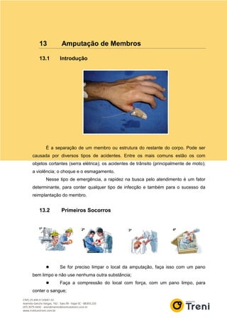 13 Amputação de Membros
13.1 Introdução
É a separação de um membro ou estrutura do restante do corpo. Pode ser
causada por diversos tipos de acidentes. Entre os mais comuns estão os com
objetos cortantes (serra elétrica); os acidentes de trânsito (principalmente de moto);
a violência; o choque e o esmagamento.
Nesse tipo de emergência, a rapidez na busca pelo atendimento é um fator
determinante, para conter qualquer tipo de infecção e também para o sucesso da
reimplantação do membro.
13.2 Primeiros Socorros
 Se for preciso limpar o local da amputação, faça isso com um pano
bem limpo e não use nenhuma outra substância;
 Faça a compressão do local com força, com um pano limpo, para
conter o sangue;
 