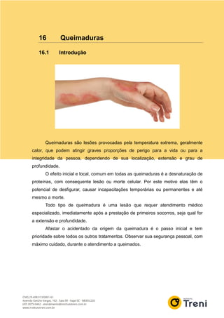 16 Queimaduras
16.1 Introdução
Queimaduras são lesões provocadas pela temperatura extrema, geralmente
calor, que podem atingir graves proporções de perigo para a vida ou para a
integridade da pessoa, dependendo de sua localização, extensão e grau de
profundidade.
O efeito inicial e local, comum em todas as queimaduras é a desnaturação de
proteínas, com consequente lesão ou morte celular. Por este motivo elas têm o
potencial de desfigurar, causar incapacitações temporárias ou permanentes e até
mesmo a morte.
Todo tipo de queimadura é uma lesão que requer atendimento médico
especializado, imediatamente após a prestação de primeiros socorros, seja qual for
a extensão e profundidade.
Afastar o acidentado da origem da queimadura é o passo inicial e tem
prioridade sobre todos os outros tratamentos. Observar sua segurança pessoal, com
máximo cuidado, durante o atendimento a queimados.
 