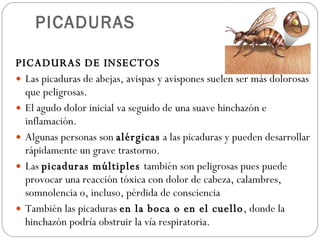 PICADURAS <ul><li>PICADURAS DE INSECTOS  </li></ul><ul><li>Las picaduras de abejas, avispas y avispones suelen ser más dol...