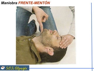 Maniobra  FRENTE-MENTÓN 