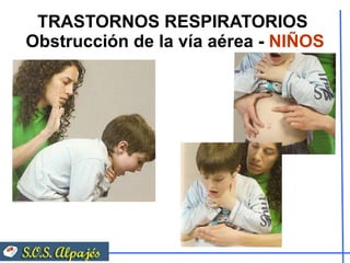 TRASTORNOS RESPIRATORIOS  Obstrucción de la vía aérea -  NIÑOS 