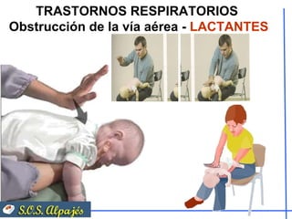 TRASTORNOS RESPIRATORIOS  Obstrucción de la vía aérea -  LACTANTES 