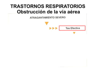 TRASTORNOS RESPIRATORIOS  Obstrucción de la vía aérea 