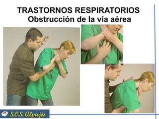 TRASTORNOS RESPIRATORIOS  Obstrucción de la vía aérea 