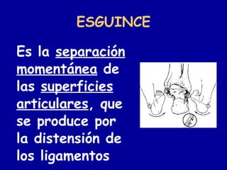 ESGUINCE <ul><li>Es la  separación   momentánea  de las  superficies   articulares , que se produce por la distensión de l...