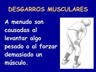 DESGARROS MUSCULARES <ul><li>A menudo son causadas al levantar algo pesado o al forzar demasiado un músculo. </li></ul>