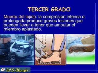 TERCER GRADO
Muerte del tejido: la compresión intensa o
prolongada produce graves lesiones que
pueden llevar a tener que amputar el
miembro aplastado.
 