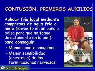 CONTUSIÓN. PRIMEROS AUXILIOS

Aplicar frío local mediante
compresas de agua fría o
hielo (envuelto en un paño o
bolsa para que no toque
directamente en la piel)
para conseguir:
 – Menor aporte sanguíneo
 – Menor sensibilidad
   (anestesia) de las
   terminaciones nerviosas.
 