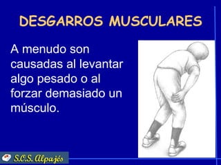 DESGARROS MUSCULARES

A menudo son
causadas al levantar
algo pesado o al
forzar demasiado un
músculo.
 