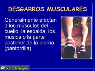 DESGARROS MUSCULARES
Generalmente afectan
a los músculos del
cuello, la espalda, los
muslos o la parte
posterior de la pierna
(pantorrilla)
 