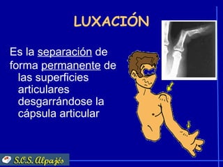 LUXACIÓN

Es la separación de
forma permanente de
  las superficies
  articulares
  desgarrándose la
  cápsula articular
 