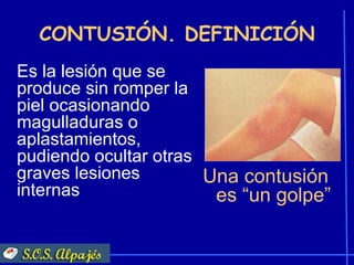 CONTUSIÓN. DEFINICIÓN
Es la lesión que se
produce sin romper la
piel ocasionando
magulladuras o
aplastamientos,
pudiendo ocultar otras
graves lesiones        Una contusión
internas                es “un golpe”
 