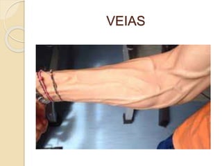 VEIAS
 