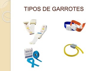TIPOS DE GARROTES
 