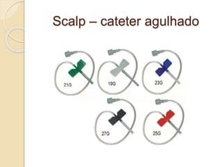 Scalp – cateter agulhado
 