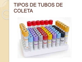 TIPOS DE TUBOS DE
COLETA
 